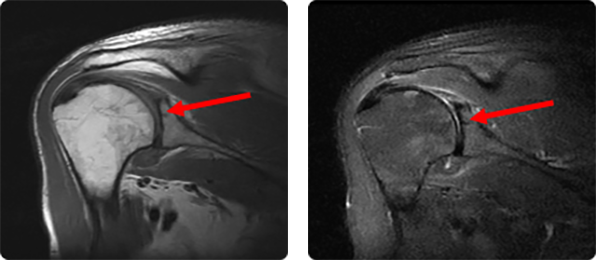 MRI 사진